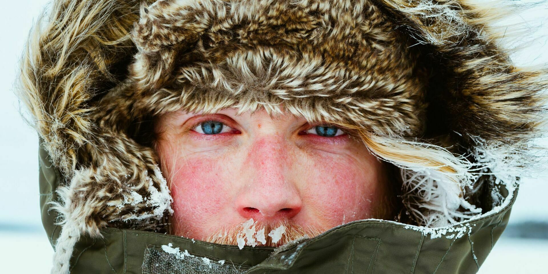 Врачи предупреждают россиян о тяжелых формах аллергии на холод
