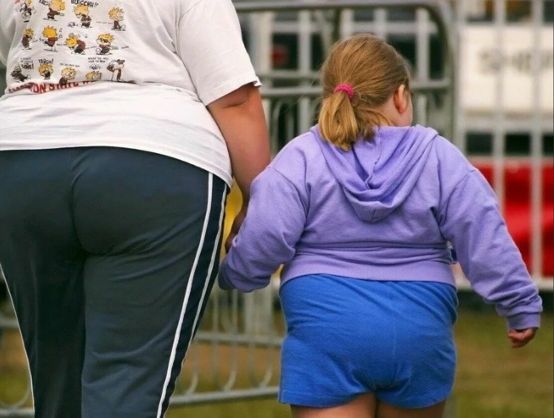Минздрав назвал регионы, где больше всего детей страдает от ожирения