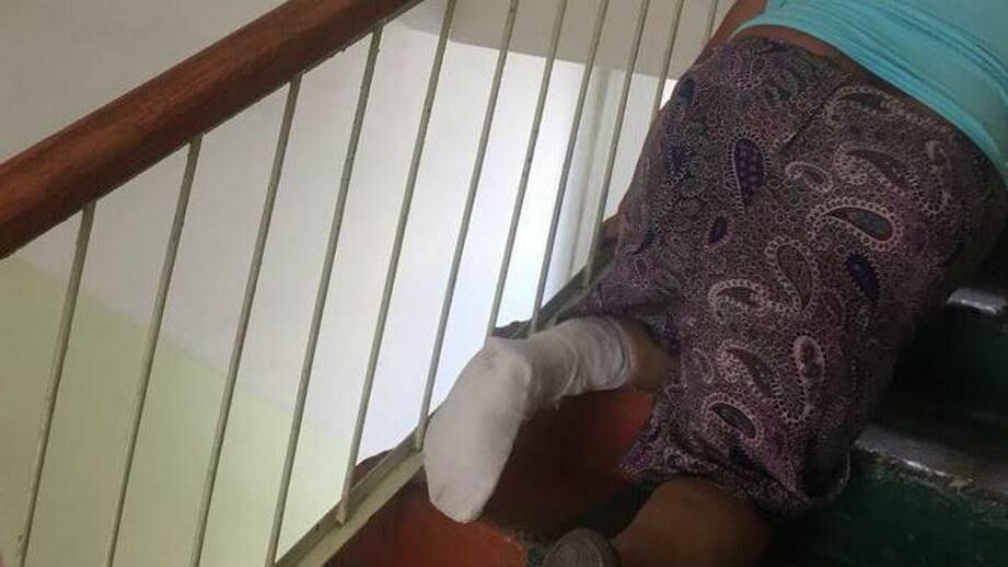 Фото дня: пенсионерка со сломанной ногой ползла по больничной лестнице