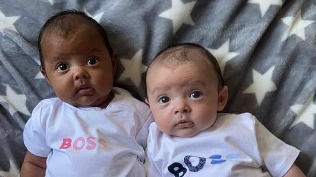 Гены пошутили: британка родила близнецов с разными цветом кожи