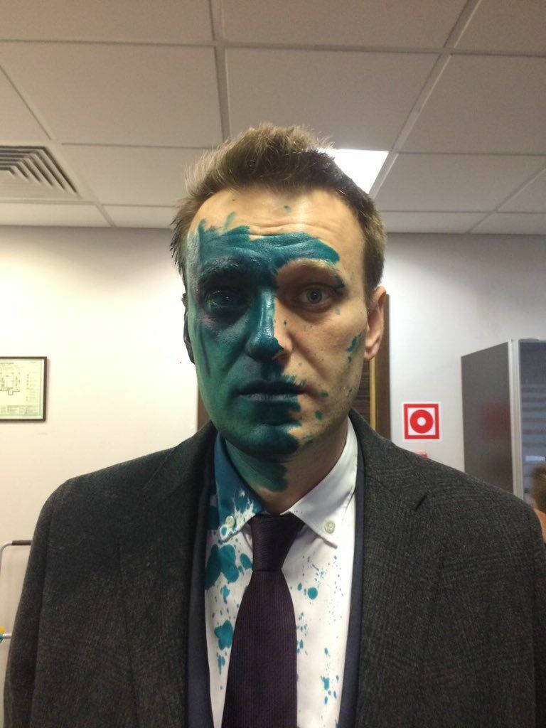 Уже не смешно. Зеленка сожгла Навальному роговицу глаза