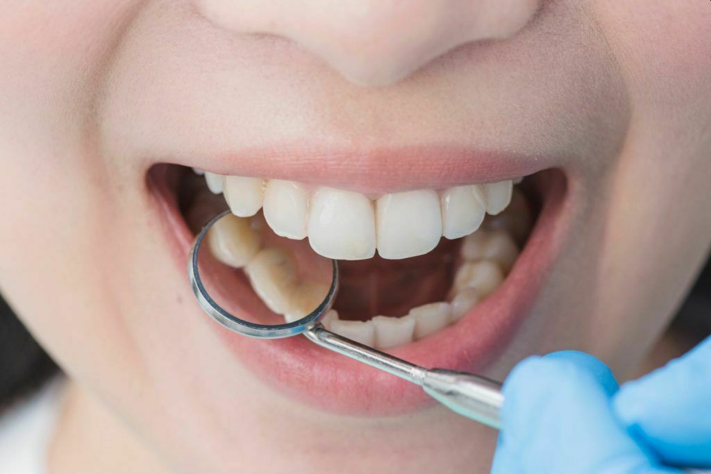 Нехватка зубов и лишние артерии: Homo Sapiens переживает микроэволюцию