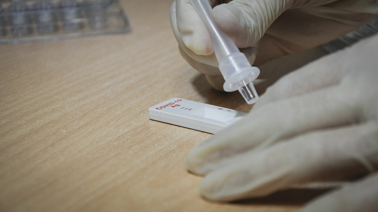 В Китае выявили новый тип генипавируса, поражающего печень и почки