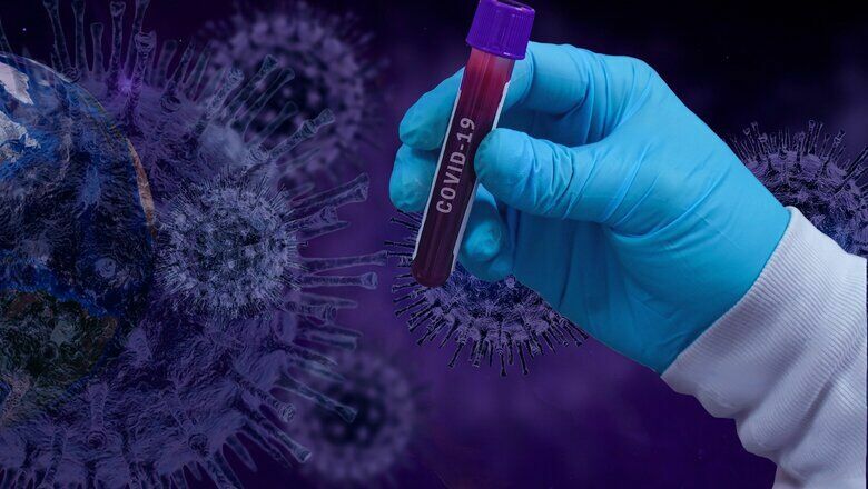 Сколько должно быть антител к коронавирусу?