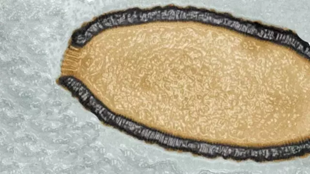 Гигантский вирус возрастом в 30 тысяч лет, найденный в вечной мерзлоте Сибири